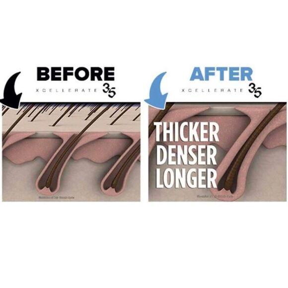 XCELLERATE 35 - LOVE Leave In/Rinse Out Conditioner. Unused but Product Unsealed - Picture 4 of 9